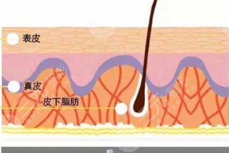 嫩膚