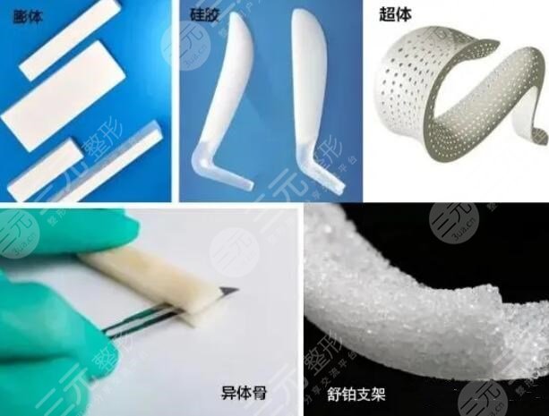 做個鼻梁需要多少錢費用？