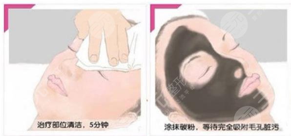 黑臉娃娃