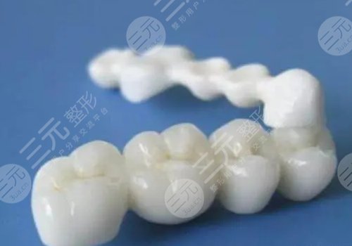 滿口烤瓷牙怎么做呢?