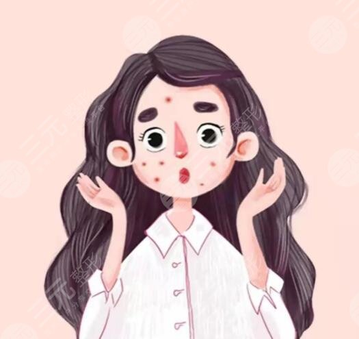復(fù)合彩光去痘幾次有？復(fù)合彩光去痘的原理和果解析，網(wǎng)友打卡后反饋~