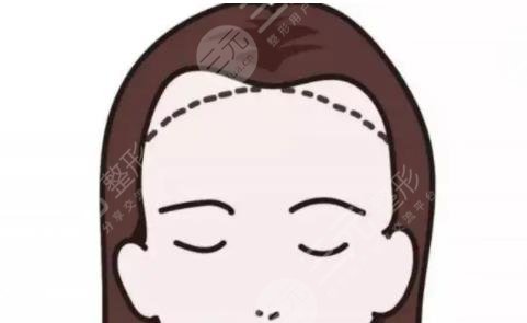 發(fā)際線