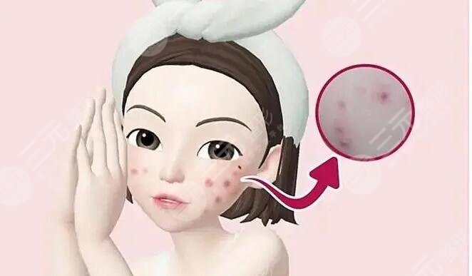 痤瘡疤痕怎么治才能徹底？這幾種有方法網(wǎng)友們親測果，給你更好選擇~