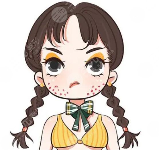 什么是痤瘡?