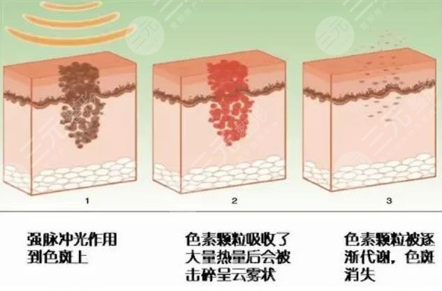 彩光嫩膚
