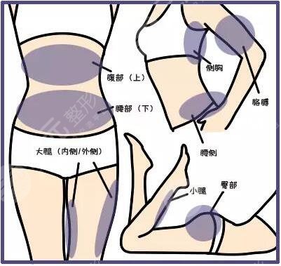等離子激光溶脂有危害嗎？