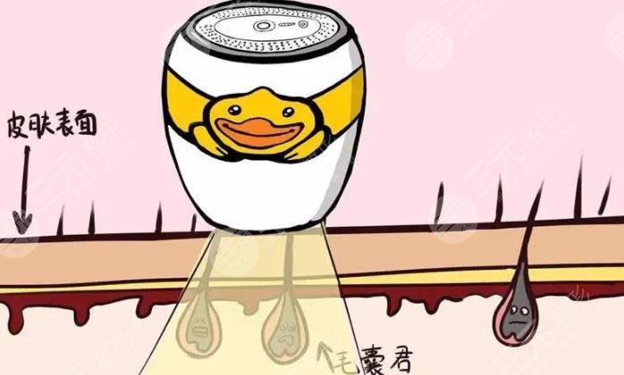 微針