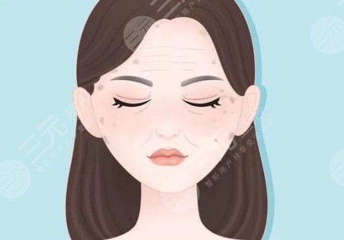 怎樣治老年斑？
