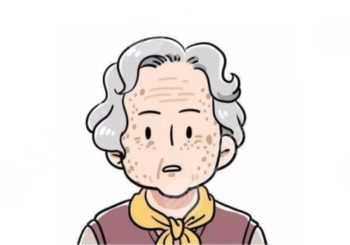 怎樣治老年斑？