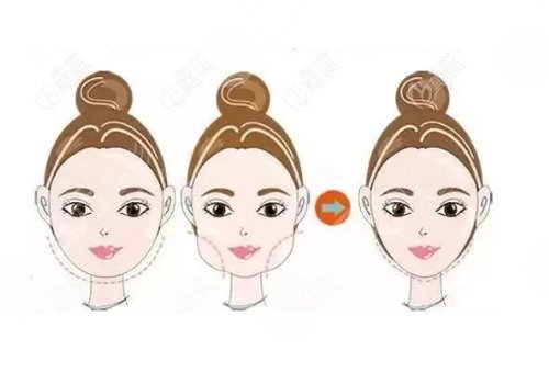 長(zhǎng)沙市雨花區(qū)臉博士醫(yī)療美容門(mén)診部怎么樣