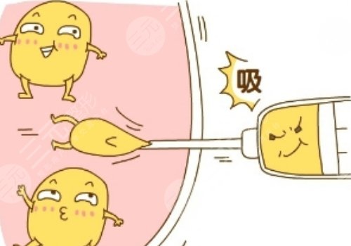腹部抽脂術(shù)后需要修復(fù)幾天才能恢復(fù)？