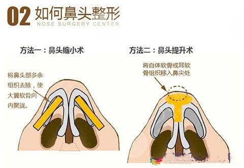 鼻頭