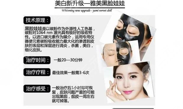 做一次黑臉娃娃?要多少錢?