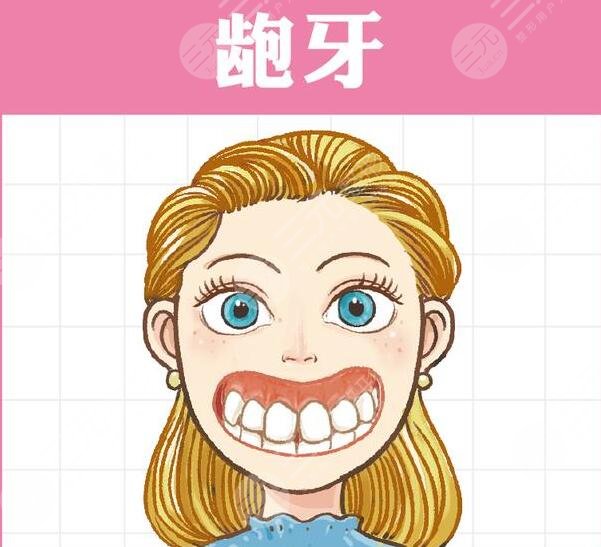 　　美容冠矯正齙牙果嗎?其實(shí)這種緩解能夠讓口腔狀態(tài)更加地正常和協(xié)調(diào)，而且也能夠讓牙齒排列的，更加的精美。通過做齙牙的矯正緩解，能夠讓整個(gè)人的口腔狀態(tài)看上去更加的自然和協(xié)調(diào)，但是想要通過做美容冠來解決自己的齙牙，這種做法是不推薦的，雖然能夠達(dá)到一定的果，但是治標(biāo)不治本，而且，這種緩解方式，并不適用于所有的齙牙。那么，美容冠矯正齙牙果如何?  　　一、美容冠矯正齙牙果嗎?  　　一般情況下，如果齙牙的程度比較輕的話，那么通過做美容冠緩解能夠達(dá)到一定的果，但是嚴(yán)重的齙牙，做美容冠其實(shí)是沒有作用的，不能夠達(dá)到齙牙的緩解果。有些輕度的齙牙，做美容冠是有代價(jià)的，而且需要在專業(yè)醫(yī)生的指導(dǎo)下磨出一部分牙齒組織，讓牙齒變得更小，然后重新套一個(gè)冠下去，并且，套一個(gè)可能沒那么齙的固定冠下去，所以說這種方式有一定的局限性，而且是不值得推薦的。  　　二、齙牙如何緩解?  　　齙牙的緩解方式主要分為拔牙和牙齒矯正，尤其是隱形正畸手術(shù)或金屬正畸手術(shù)。有齙牙的患者，建議去做正畸緩解，通過做該緩解，能夠讓牙齒排列的更加的正?；蛘呷绻麌?yán)重，還可以去專業(yè)的醫(yī)院完成正頜外科方面的手術(shù)，包括聯(lián)合箍牙、矯牙的緩解來進(jìn)行矯正。  　　1、做拔牙緩解。其實(shí)拔牙緩解能夠讓整個(gè)人的口腔狀態(tài)看上去更加的美觀，而且拔出了大多數(shù)的牙齒之后，整個(gè)人的口腔狀態(tài)也會(huì)更加的協(xié)調(diào)齙牙的存在，也能夠得到更好的改良。  　　2、做牙齒矯正手術(shù)。做牙齒矯正手術(shù)，包括隱形正畸手術(shù)和金屬正畸手術(shù)，而且需要佩戴牙套，再佩戴了牙套之后牙齒才會(huì)排列的，更加的整齊和美觀。一般分為隱形的牙套和金屬的牙套，隱形的牙套是可以自行摘戴的，而且美觀都是相對(duì)較好的，雖然金屬牙套不能夠自行摘戴，但是能夠起到更好的塑形果，其實(shí)也是一種不錯(cuò)的操作。在佩戴牙套大概一年左右的時(shí)間再取下來，整個(gè)人的口腔狀態(tài)看上去就會(huì)更加的美觀，并且牙齒也會(huì)更加的自然和協(xié)調(diào)，一般不會(huì)出現(xiàn)劇烈的刺痛感和疼痛感，但是需要對(duì)口腔進(jìn)行一定的護(hù)理。  　　3、做正頜手術(shù)。做任何手術(shù)能夠讓牙齒排列的更加的整齊，也能夠讓整個(gè)人的牙槽骨看上去更加的自然和協(xié)調(diào)，做完緩解之后牙齒是一般不會(huì)脫落的。  　　三、美容冠矯正齙牙的注意事項(xiàng)  　　其實(shí)，做牙齒方面的緩解一定要找專業(yè)的醫(yī)生進(jìn)行操作，不能夠盲目的開展緩解。而且做完緩解之后，也要多吃新鮮的蔬菜和水果，少吃辛辣油膩以及刺激性的食物，不能夠經(jīng)常熬夜，否則可能會(huì)影響自己牙齒的恢復(fù)。同時(shí)也要注重自己日常的口腔清潔和護(hù)理，如果出現(xiàn)了牙菌斑滋生的現(xiàn)象，那么就要找醫(yī)生進(jìn)行一定的緩解，不能夠經(jīng)常不刷牙，否則可能會(huì)導(dǎo)致牙齒細(xì)菌增多影響口腔的健康。