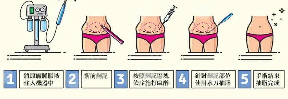 抽脂