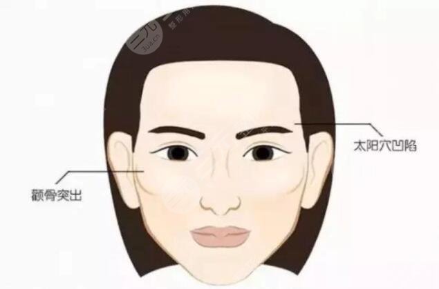 豐太陽穴的方法都有哪些呢?