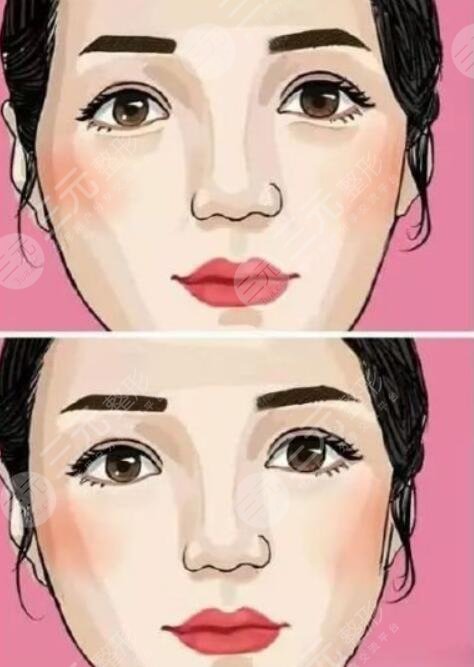 豐太陽穴的方法都有哪些呢?