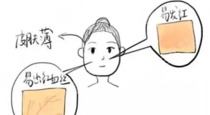 去紅血絲
