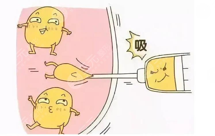 哪種減肥方法有?效不反彈?