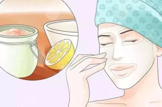 果酸換膚