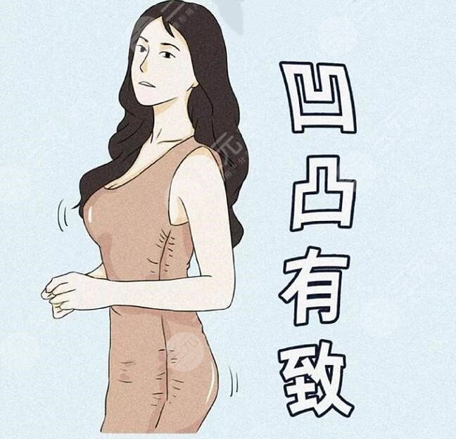 隆胸整形手術
