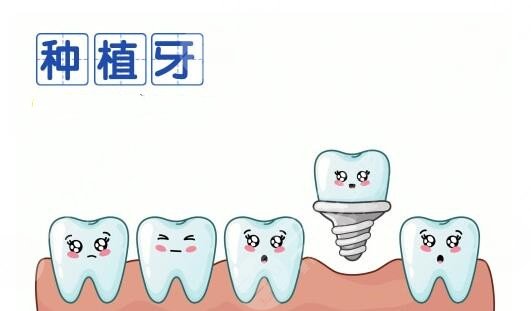 種植牙齒多少錢？