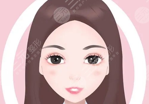蘋果肌太大怎么改良？