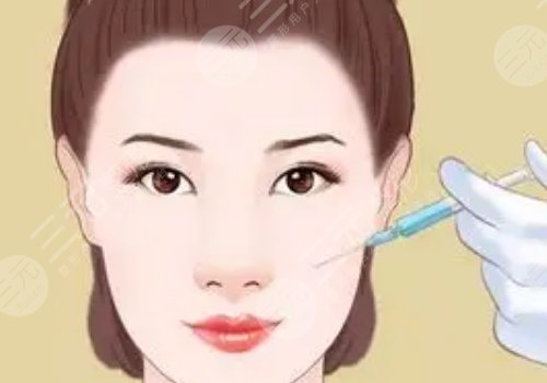 婕爾玻尿酸可以打哪些部位？