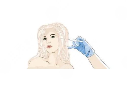 婕爾玻尿酸可以打哪些部位？