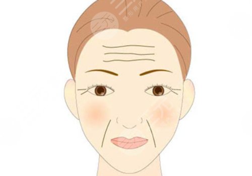 如何去除抬頭紋？