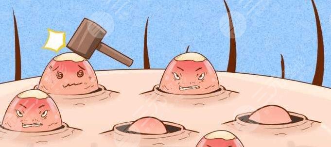 快速祛痘小竅門有哪些？外防內(nèi)治讓效果更徹底！找對長痘根源才是關(guān)鍵！