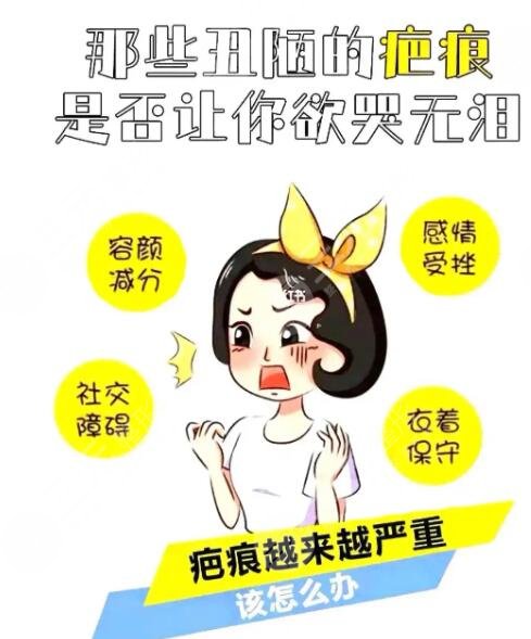 像素激光去疤痕要做多少次才能好有效果？技術原理分析及實際效果參考