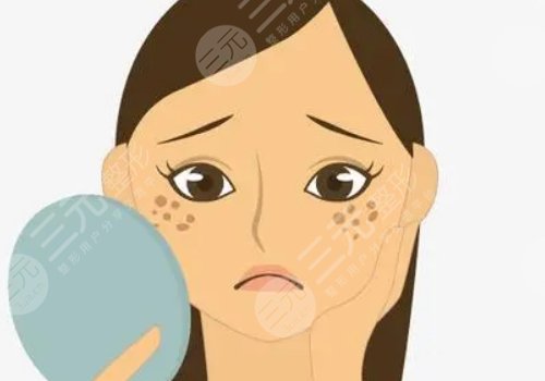 激光祛斑會(huì)不會(huì)反彈？需要做幾次？