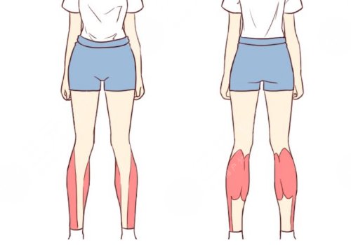 小腿吸脂后多久可以正常走路？