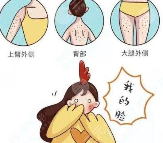 激光緩解