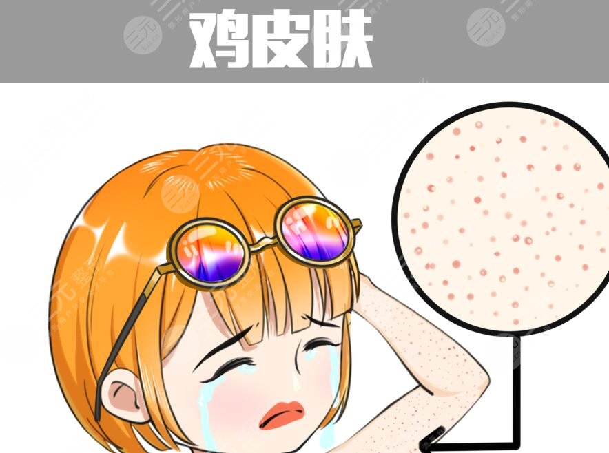 雞皮疙瘩皮膚怎么治見效快？預防和根治雙重入手，避免反復發(fā)作！