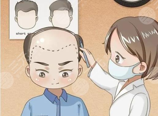 植發(fā)