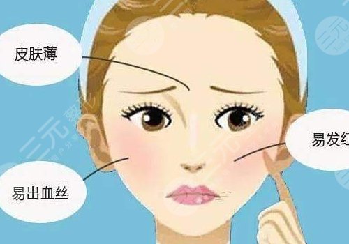 紅血絲皮膚用什么護(hù)膚品？3
