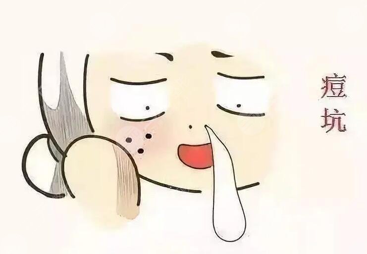 激光磨皮去痘印有效嗎？手術注意事項有哪些？哪些人適合做？