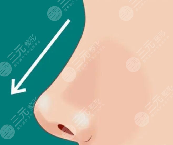 徐士亮做的鼻子好看嗎?
