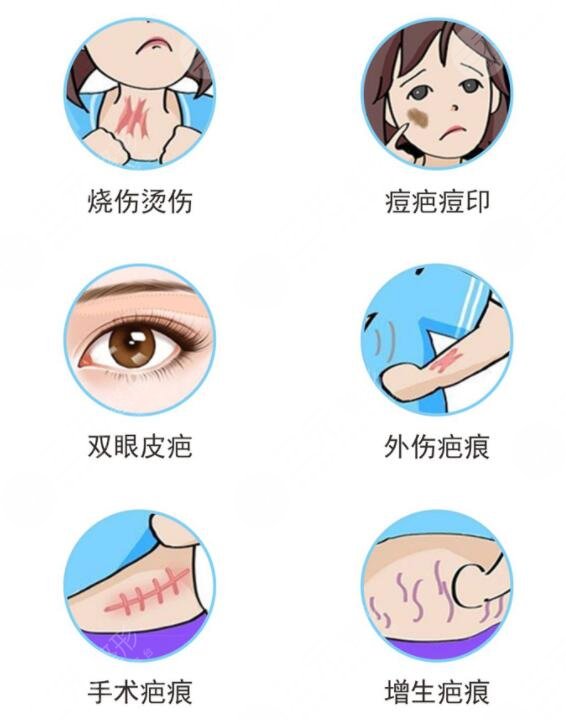 像素激光去疤術(shù)后注意事項