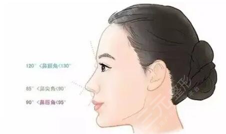 自體軟骨隆鼻好不好看？是從哪里取軟骨？?jī)?yōu)缺點(diǎn)一文匯聚！