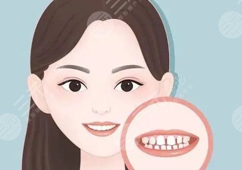 冷光美白牙齒對牙齒有什么傷害？