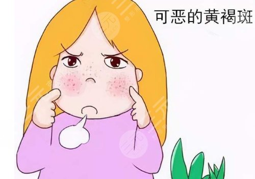 怎樣去除面部黃褐斑有效？