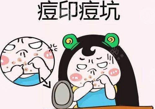 臉上有痘印怎么辦才能去掉呢？