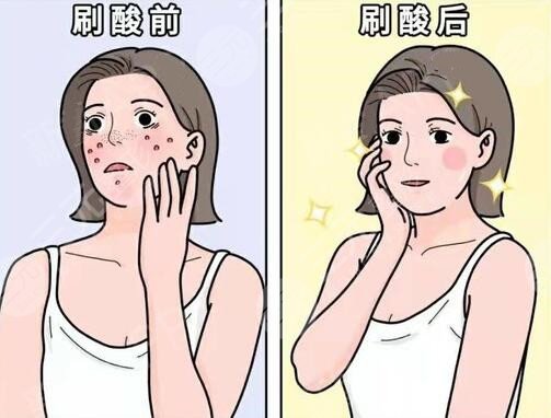 果酸換膚的價(jià)格貴不貴?