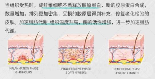 7d聚拉提和半島超聲炮的區(qū)別