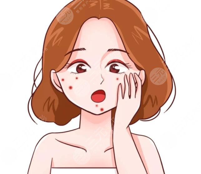 祛痘有效方法有效可行，護(hù)理注意事項(xiàng)|內(nèi)調(diào)