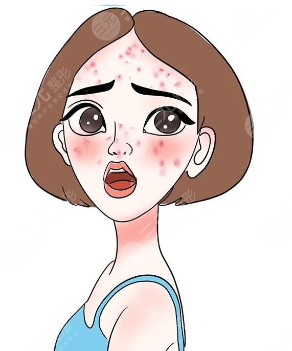 生長痘痘如何護(hù)理?