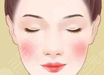 激光去紅血絲會(huì)反彈嗎